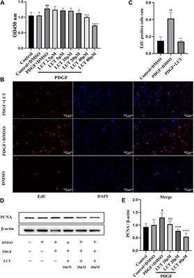 Luteolin Ameliorates Experimental Pulmonary Arterial Hypertension via Suppressing Hippo-YAP/PI3K/AKT Signaling Pathway